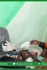 Wiil yar oo Saddex meel ka saxarooda, dhibaato badanna ka mara.