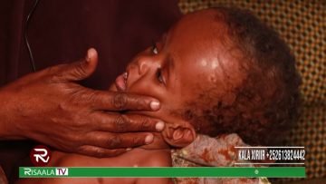 Wiilkeyga habeen iyo maalin maseexdo xaaladiisana gudaha dalka waxba loogama qaban karo